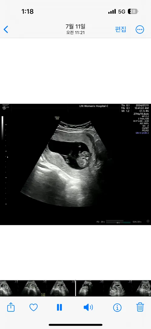 15주4일 성별이 뭘까요