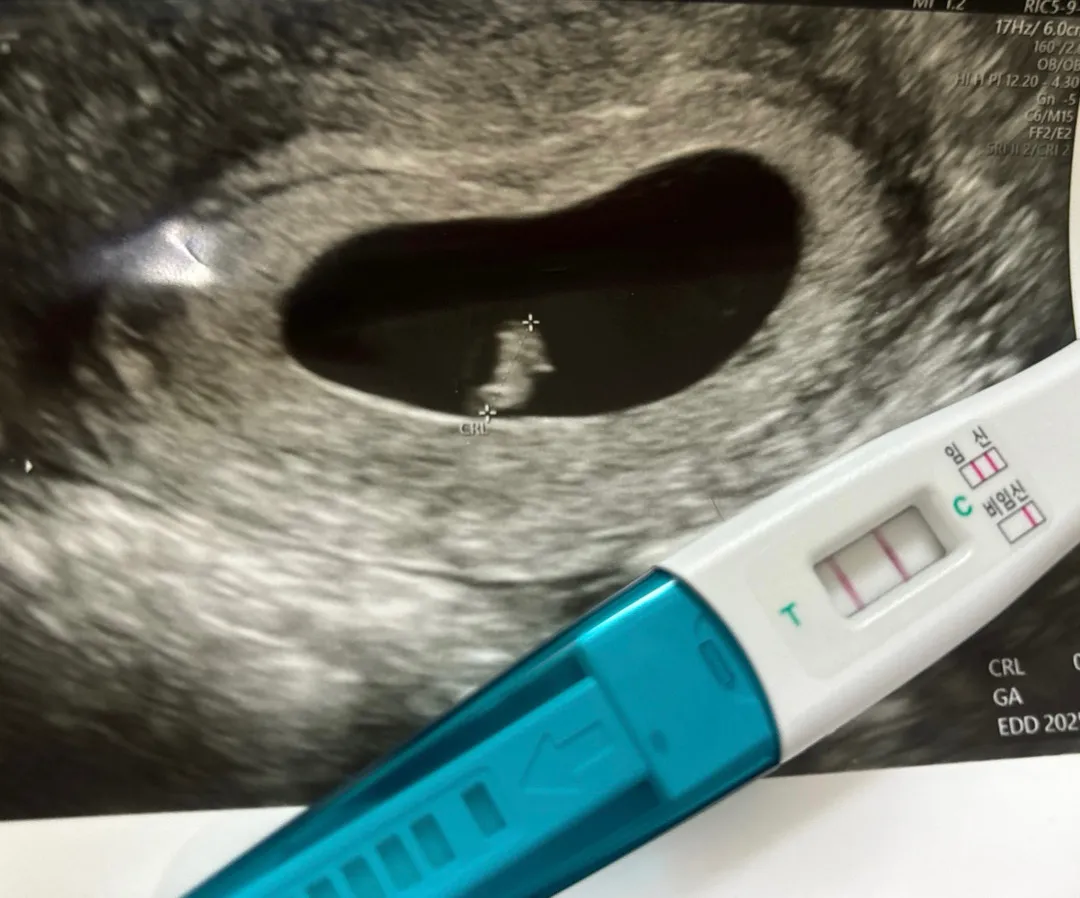 영양제 멀 먹어야할지모르겠어여 ㅜ 