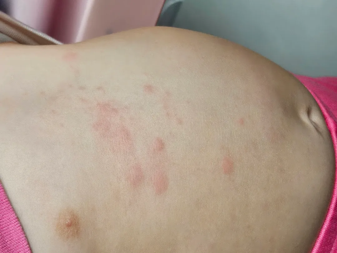 피부좀 봐주세요ㅠ