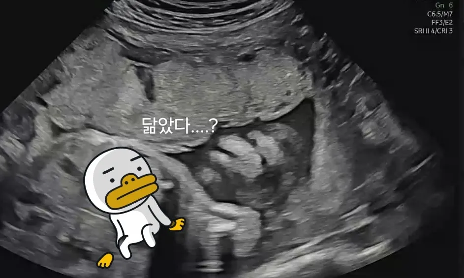 우리 애기 엽사♡