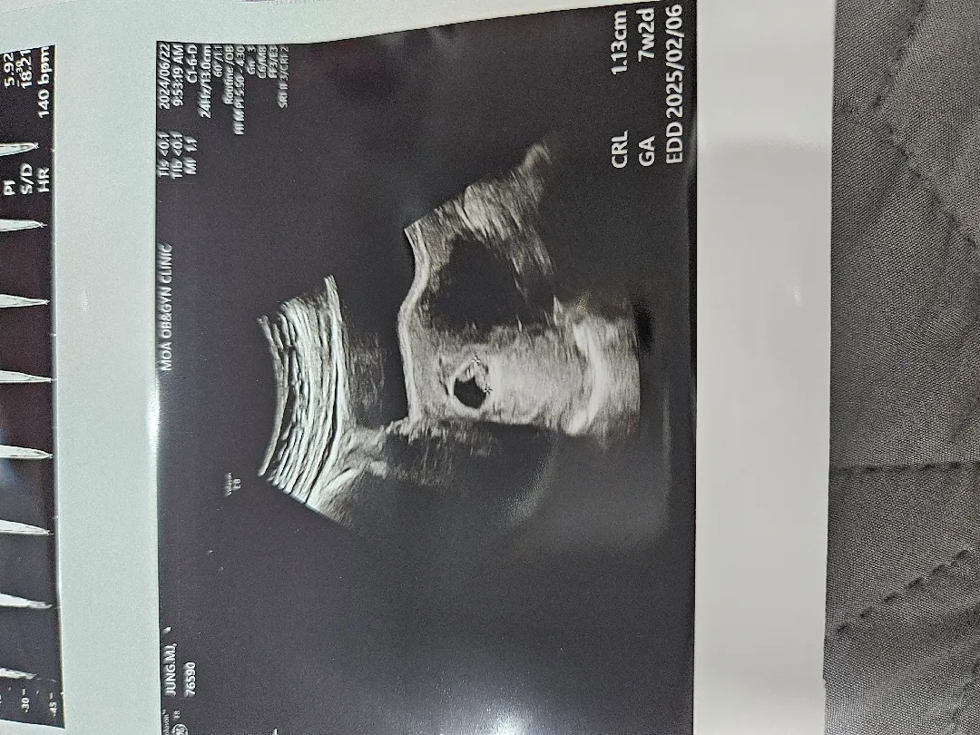 아기집이 너무 작아요...