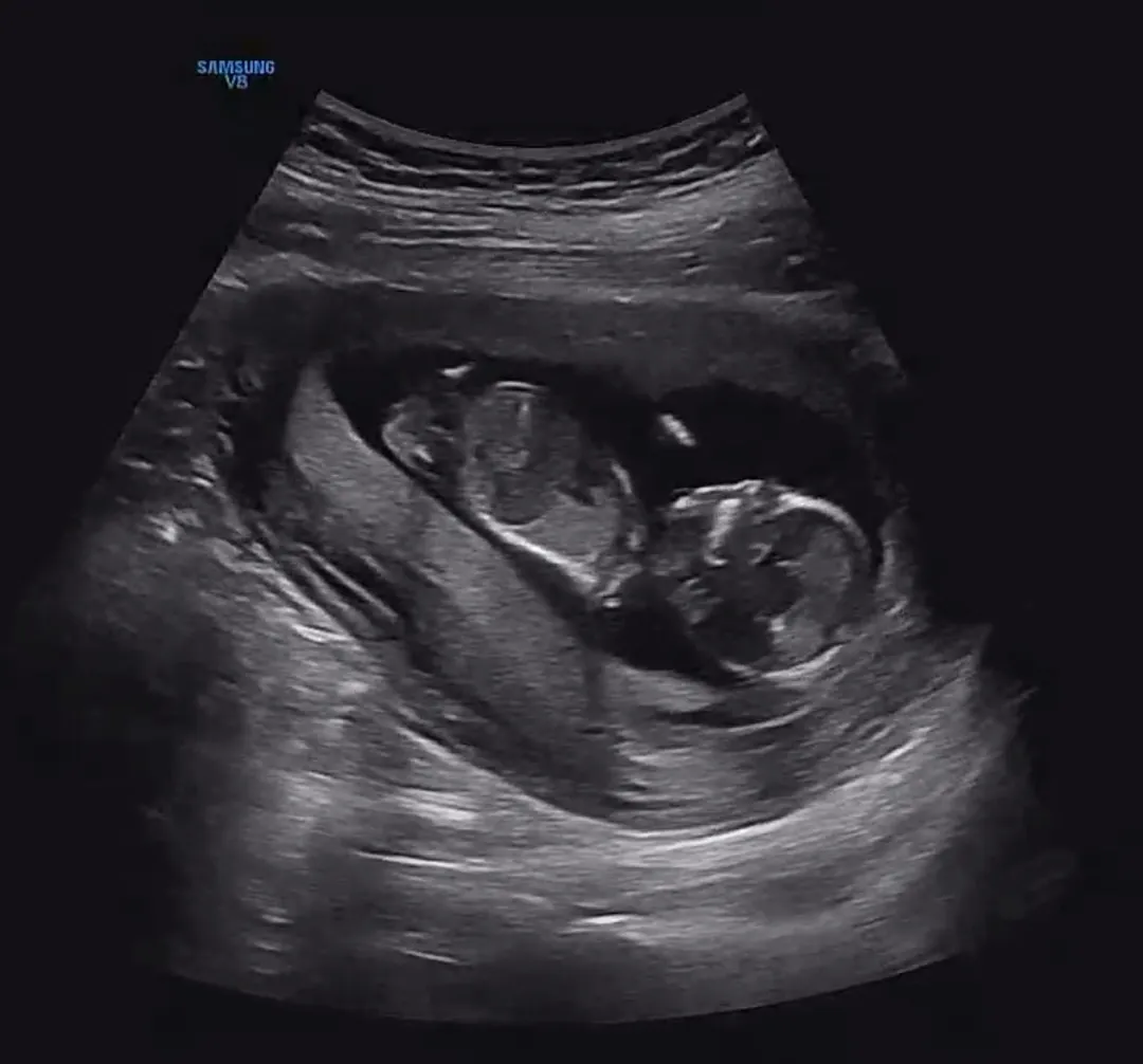 12주6일 각도법 볼수있을까요 ? :)