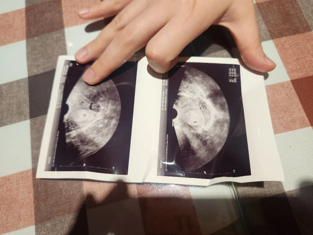임밍아웃 시기...ㅎㅎ