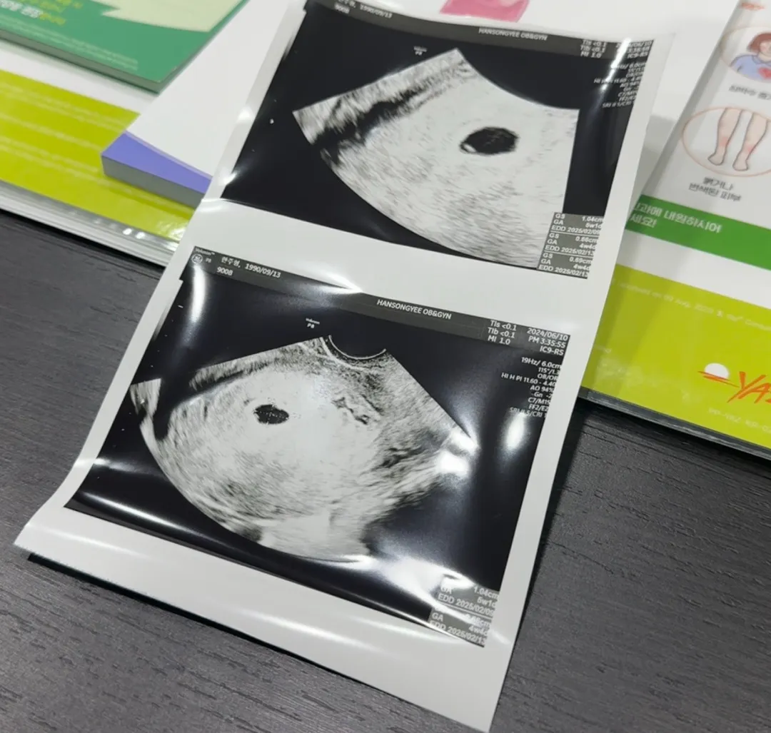 으아!!! 꿈에 그리던 아기집 보구 왔어요!!!!!