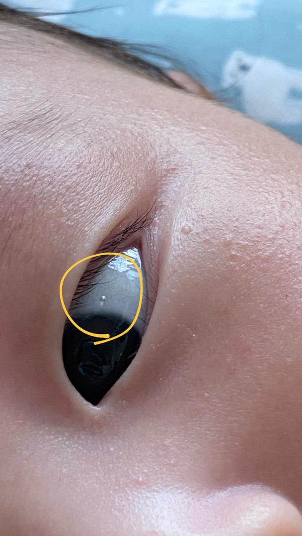 상세 이미지