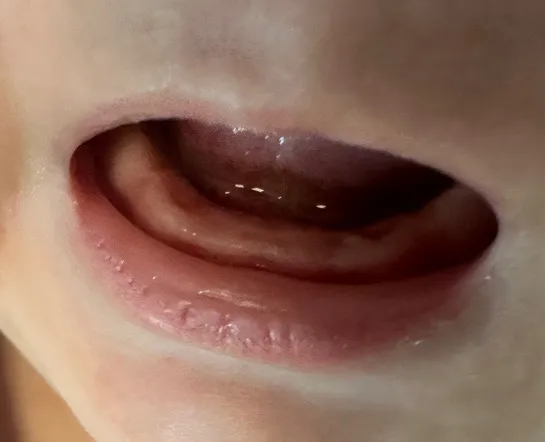이앓이 봐주세요
