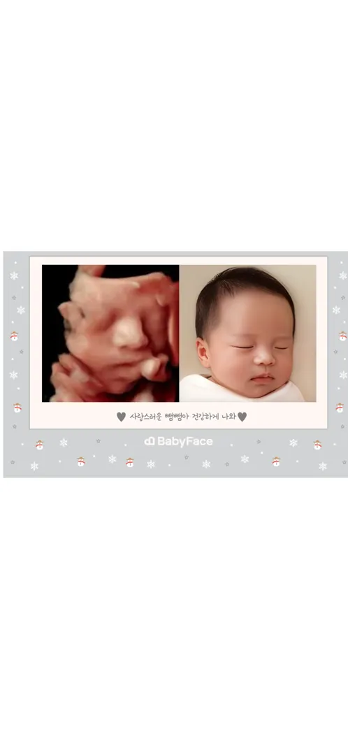 베이비 페이스