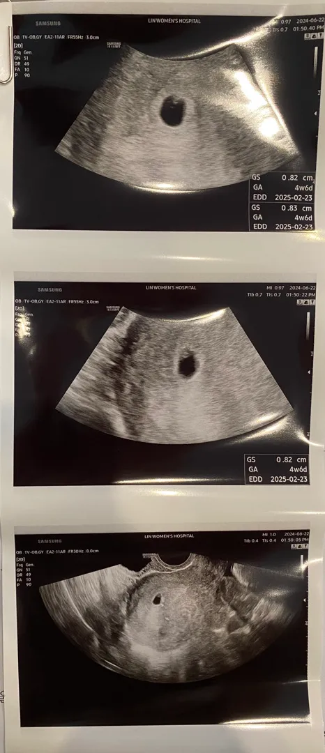 4주 6일 첫 초음파 보고왔어요!