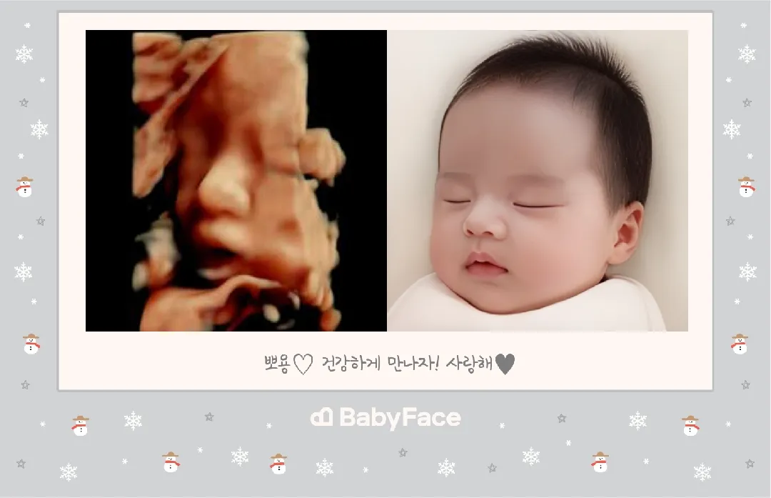 입초후 베이비페이스 해봤어요