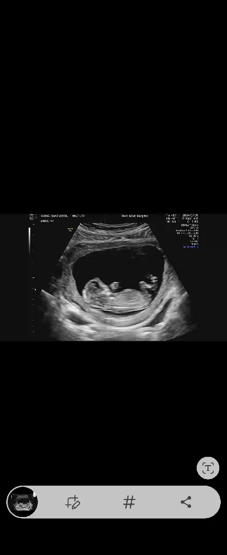 각도법 너무 궁금해요ㅠㅠ 느낌이오시나요?!?!ㅎ