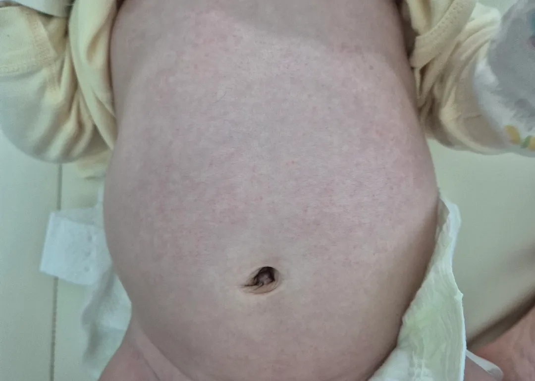 피부 왜이럴까요 ㅠㅠ