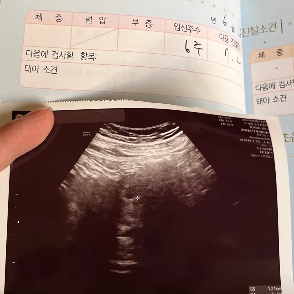 22살 어린 엄마가 됐어요