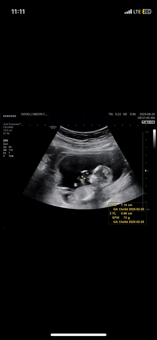 13주 0일 각도법 봐주세요 이모들 👶🏻🤍