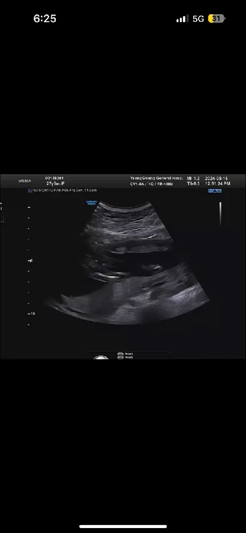 쌍둥이 후둥이는 성별좀 봐주세요!! 고수님들❤️