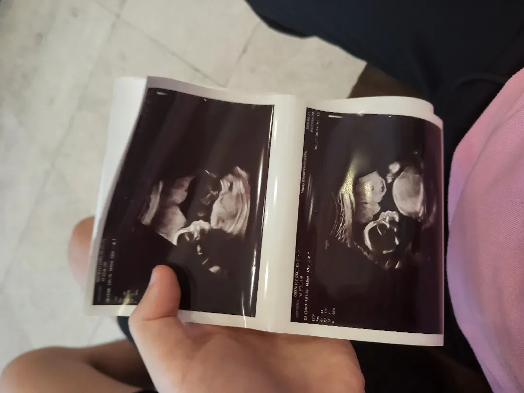 05맘인데 태동을전 못느끼겠던데..임신한지 벌써 5개월이라는데 20주 전혀몰랐어요..