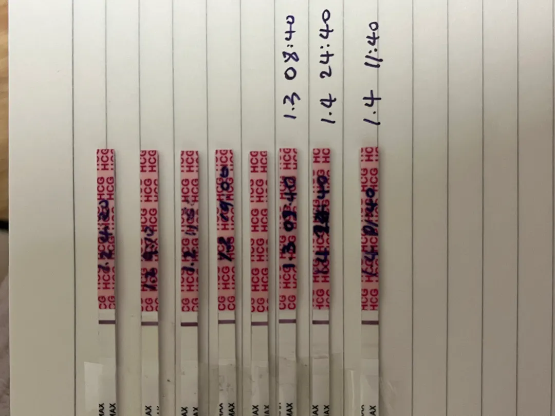 내일 병원 갈까요 토요일에 갈까요??