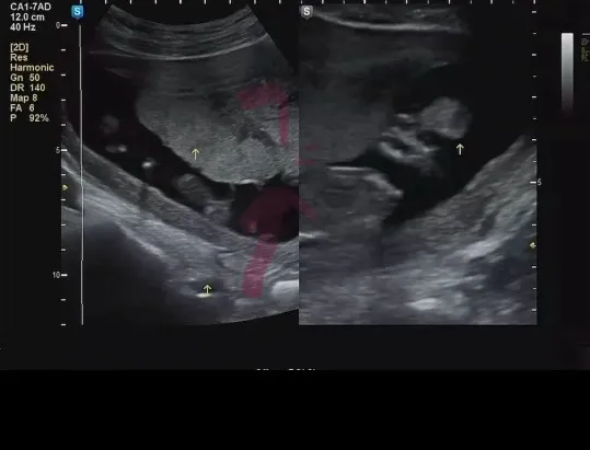 하얀거 뭔지 아시는분 계실까요..?