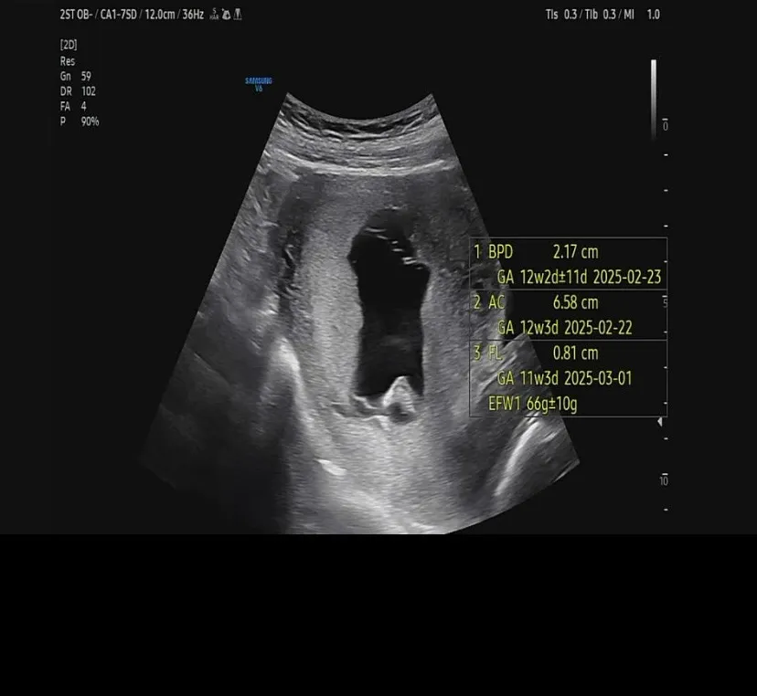 12주차 태아무게