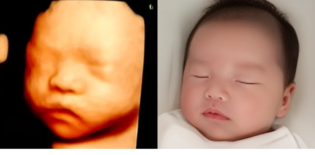 오늘 저희 딸 입체초음파 보고 왔어요~~