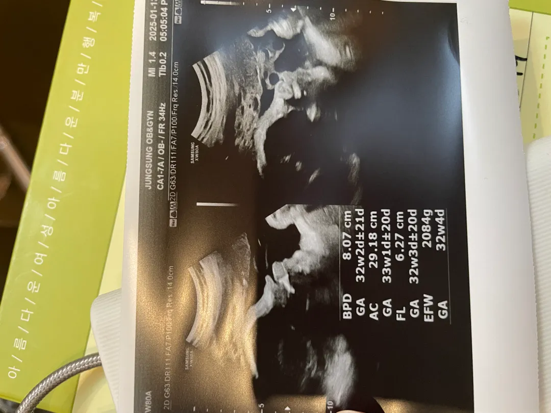 33주 옆모습 초음파좀 봐주세요..