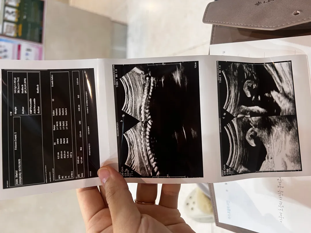 비급여 초음파 비용