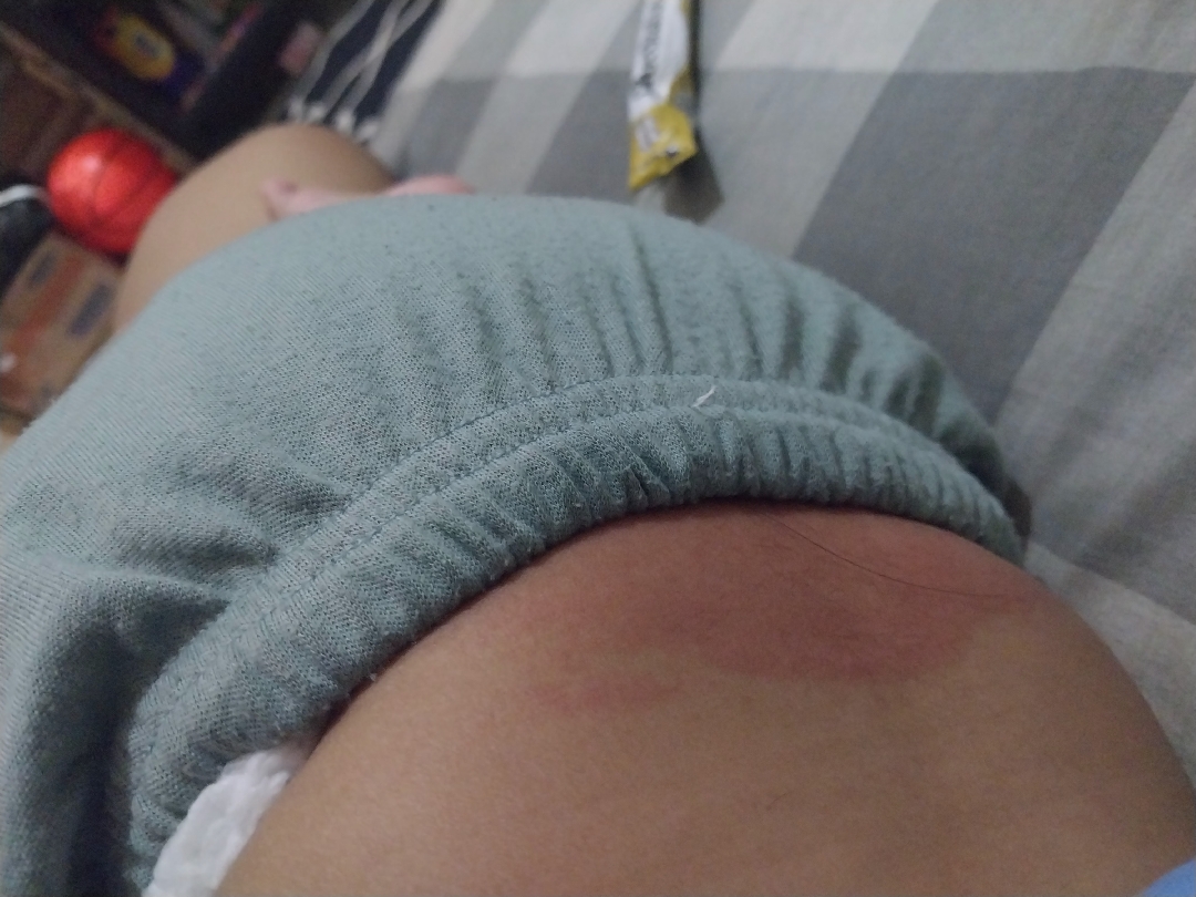 pinggang bayi merah