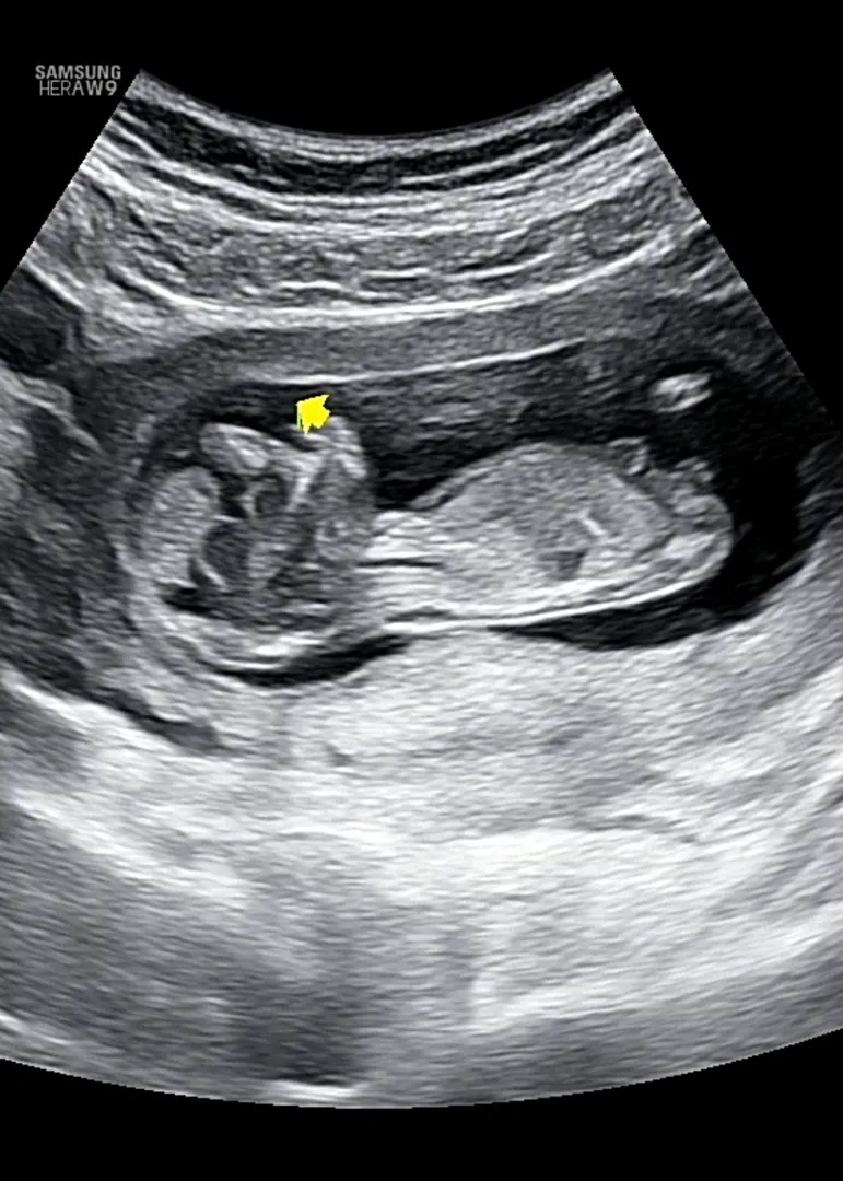 각도법 보실 줄 아시는 분 계실까요?👶🏻