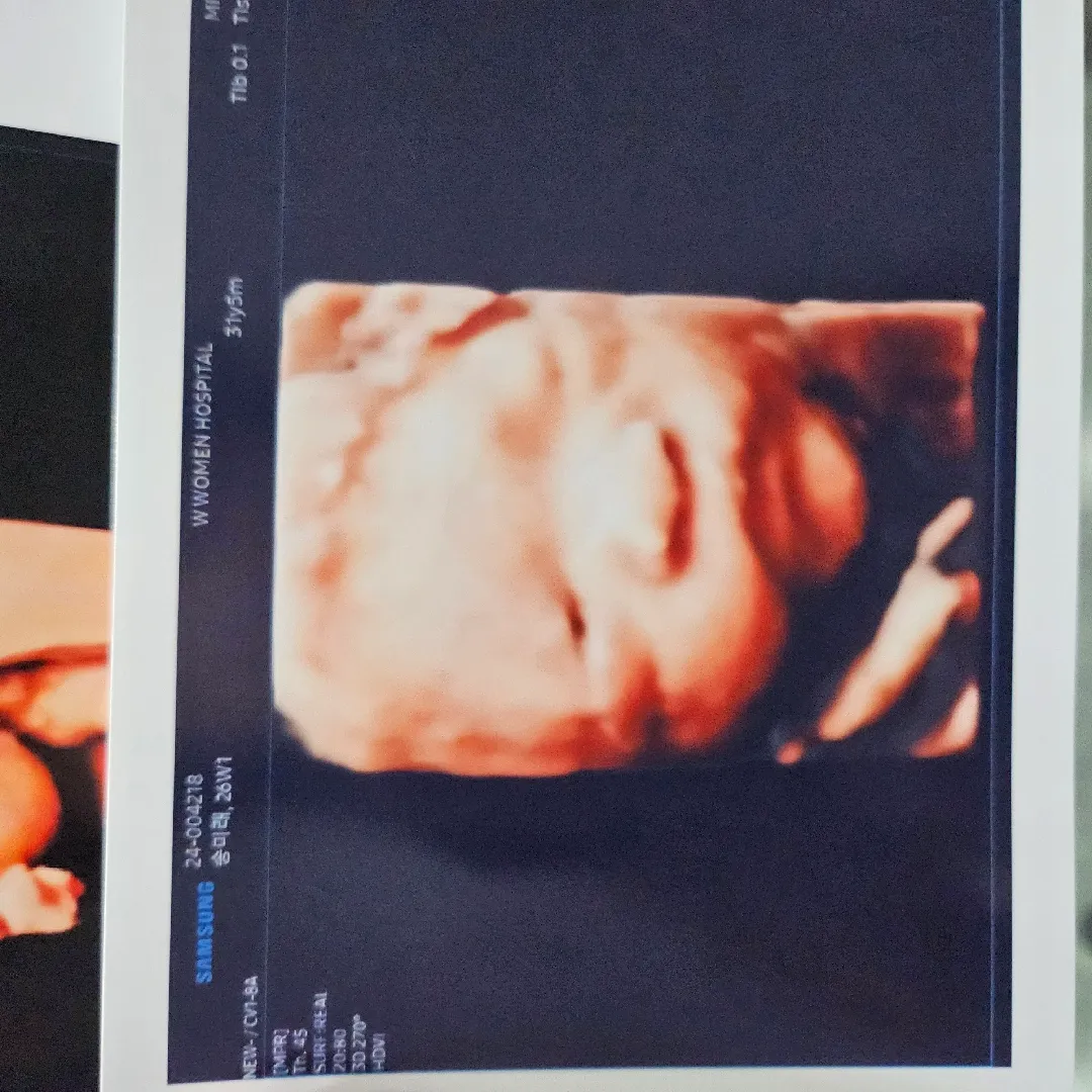 입초성공! 눈뜬사진 겟👀