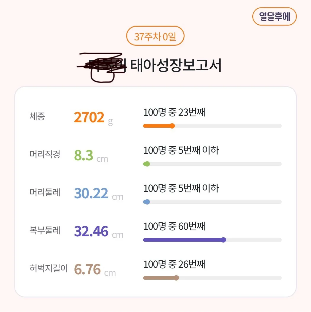 37주 태아머리가 작아요 (사진첨부)