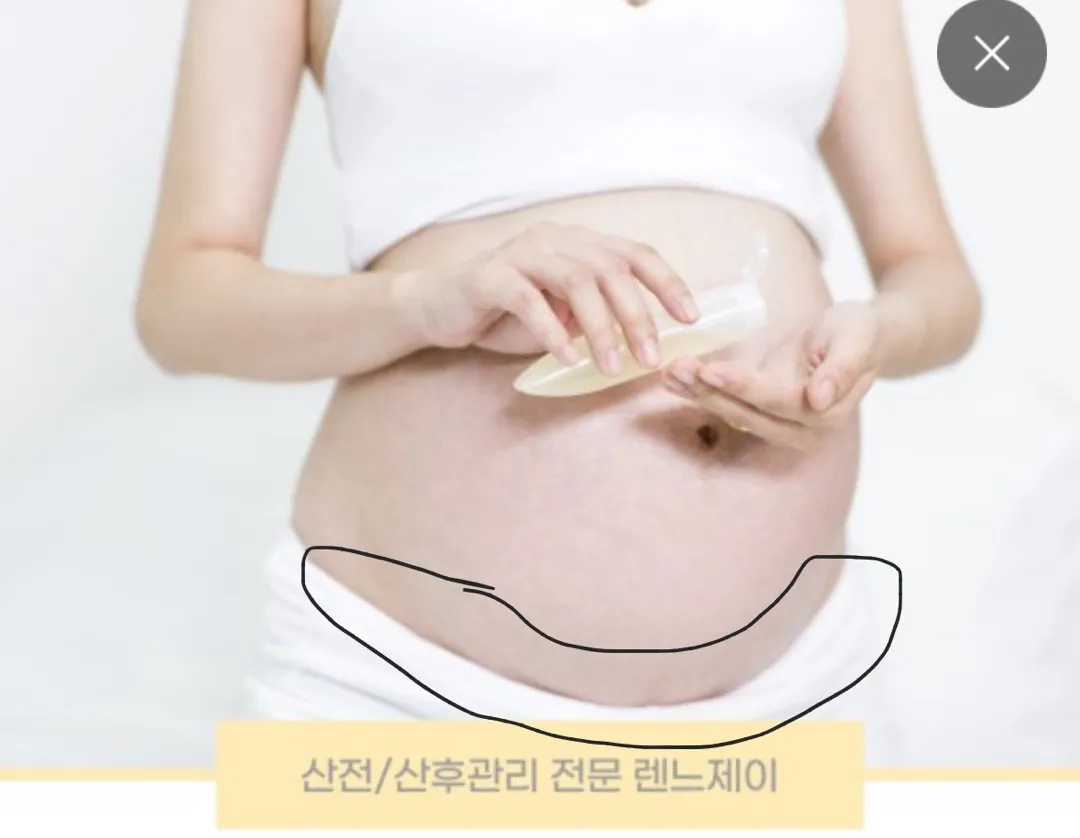 골반통증?
