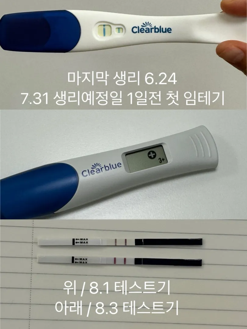 임테기 한번만 봐주세요! (이 정도 진하기면 난황도 볼 수 있을까요?!)