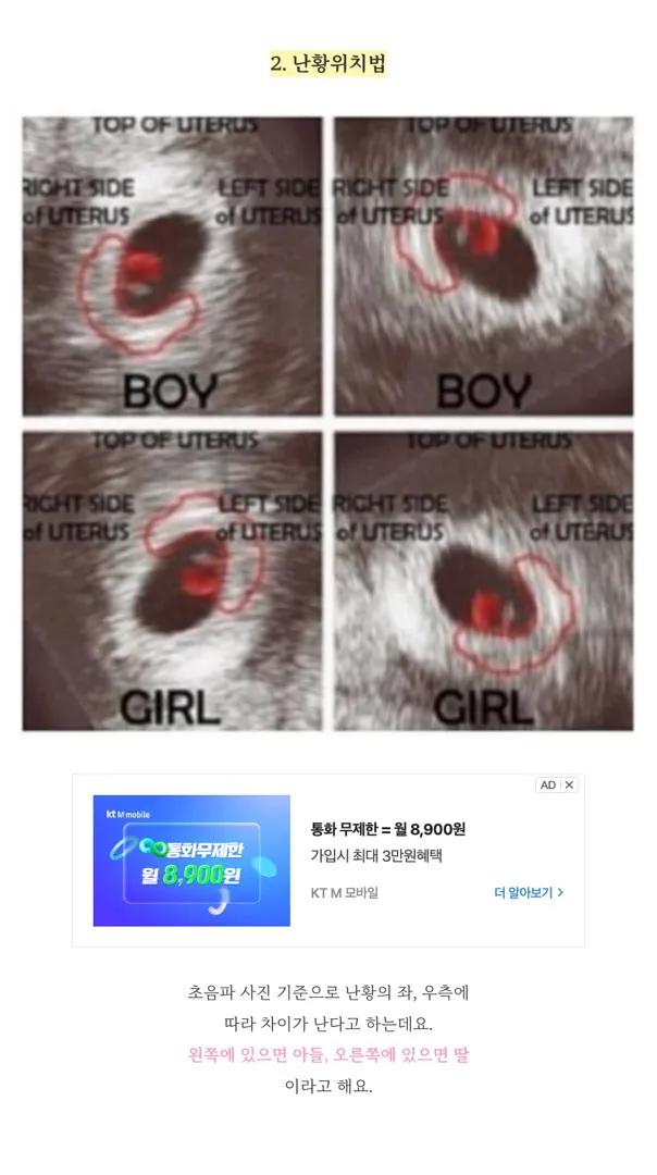 난황위치법으로 성별 맞히신 분 계실까요?