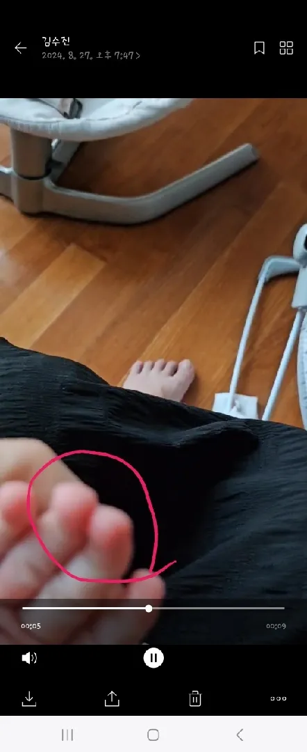 41일 아기 손가락이  문제있는건가요?ㅜ