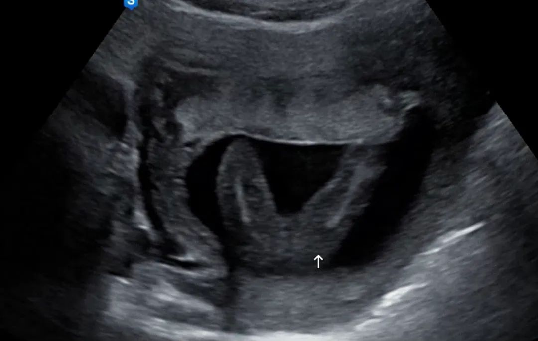 딸랑구 확정이에용👶🏻❤️