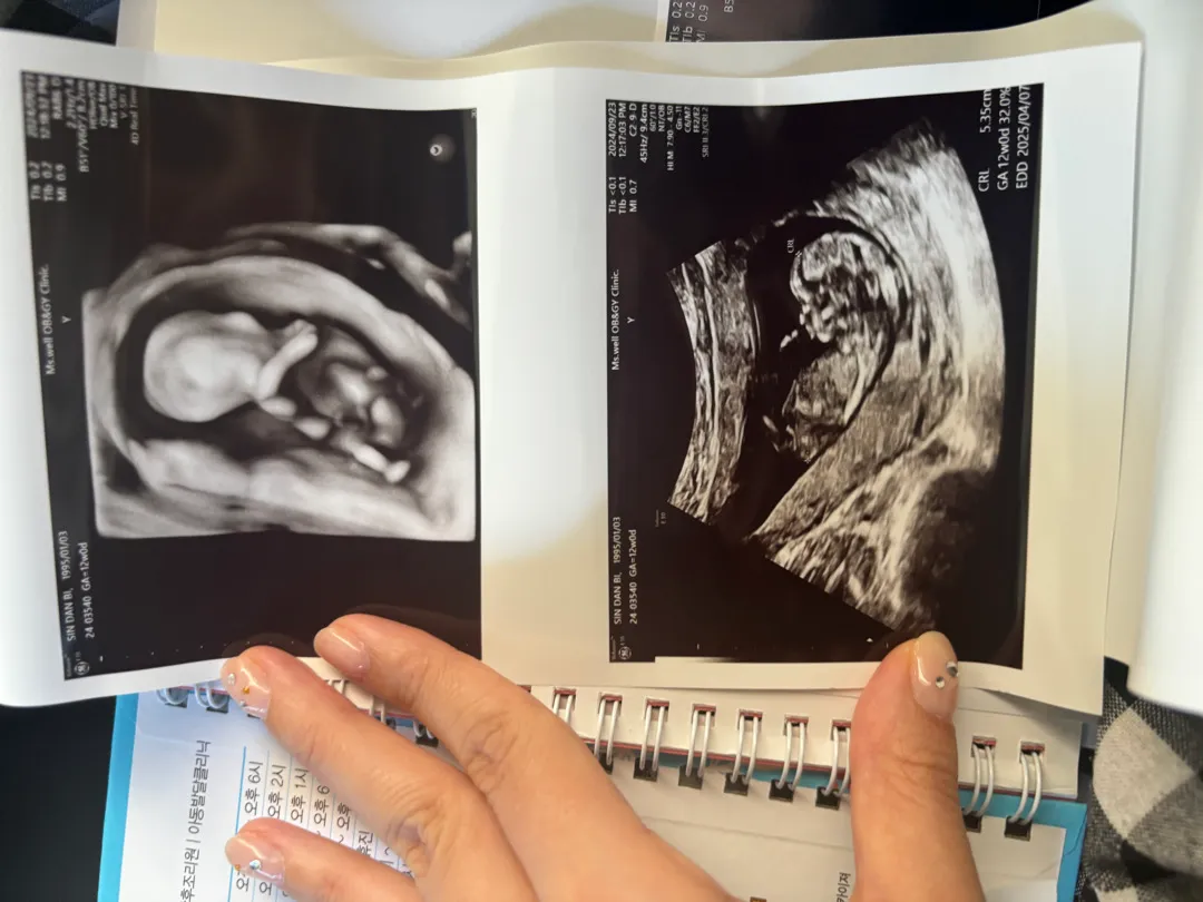 12주차 성별 각도법 잘봐주시는분 도와주세요🥰