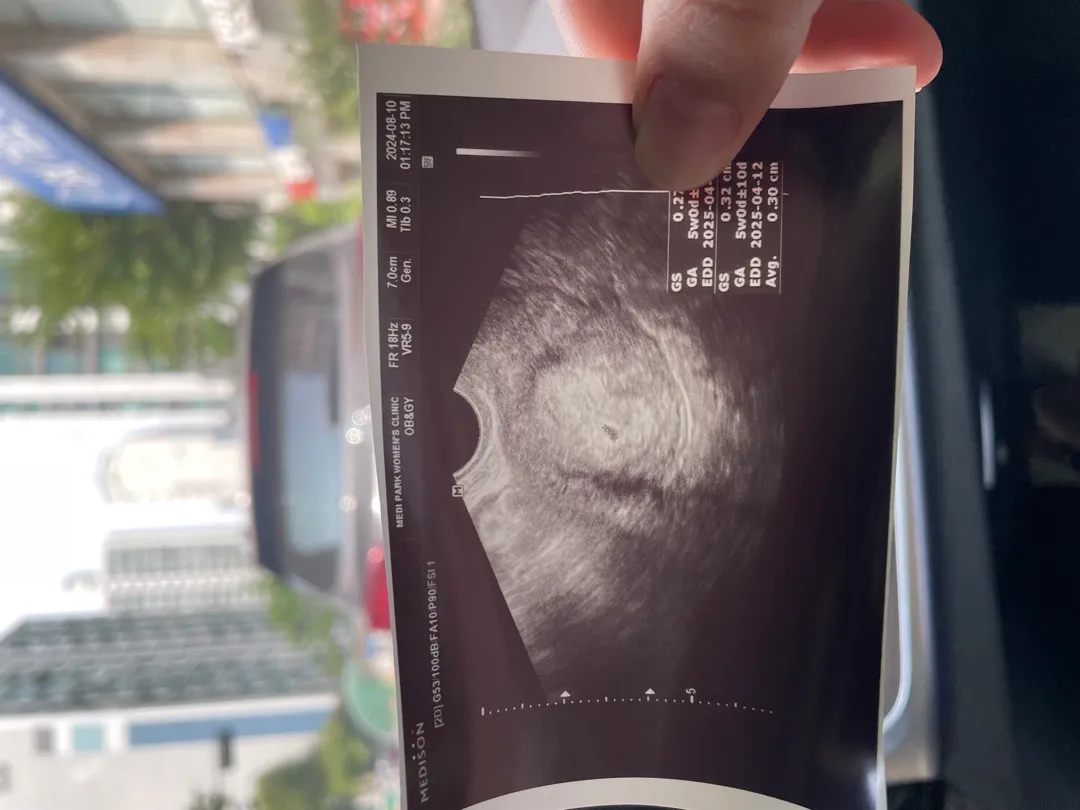첫 초음파 ㅜㅜ 