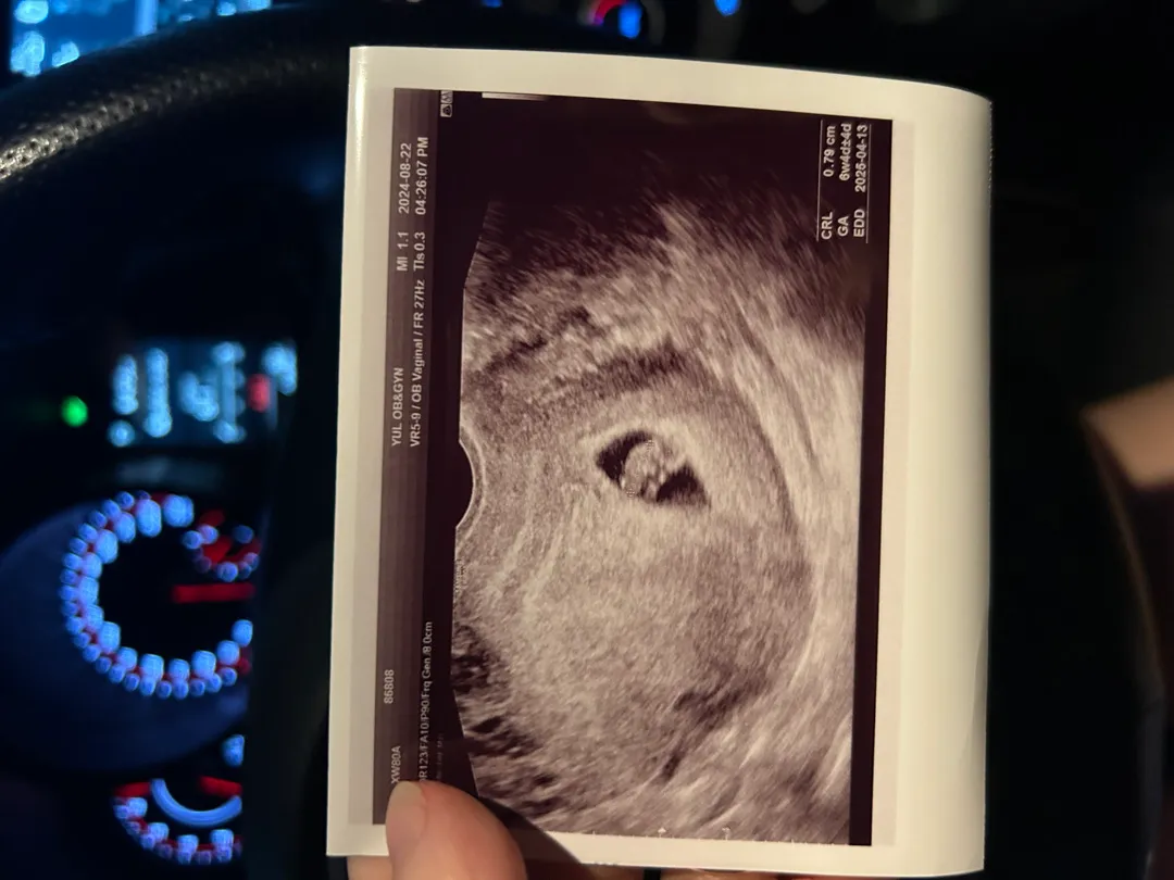 6w4d 초음파 🤍