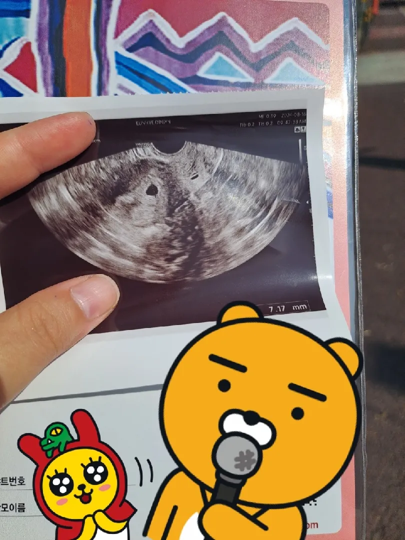 아기집 첫 확인하고 산모수첩도 받었어요