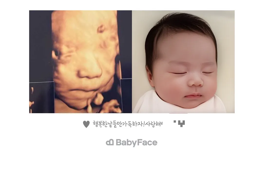 베이비페이스 후기! 추천코드!