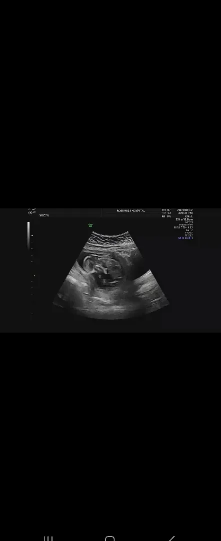 13주2일째입니다