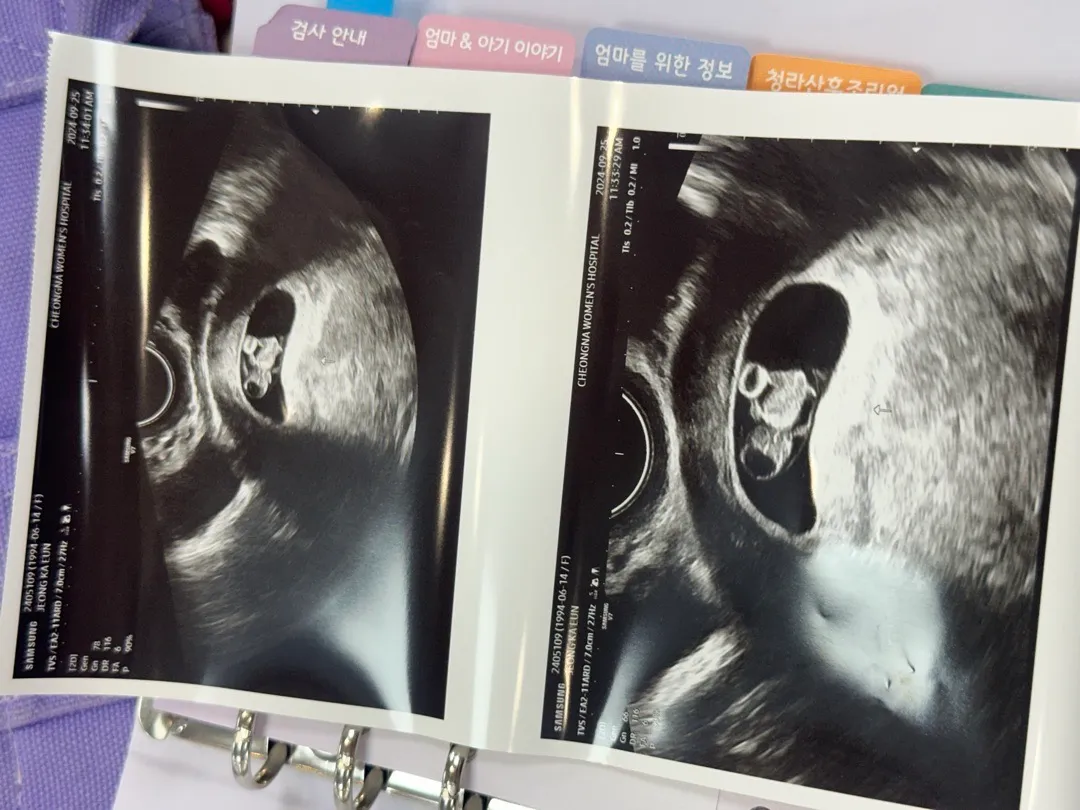 8주 초음파 팔다리가 어디있는걸까용..?