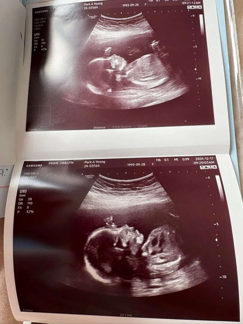 출산때까지 입덧..ㅠㅠ 다들어떠세유