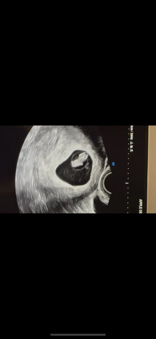 8주3일 촘파 봐주세웅