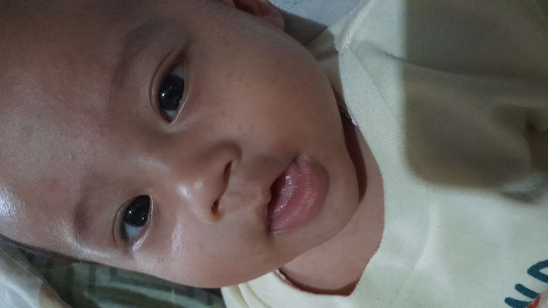 Merah² dimuka
