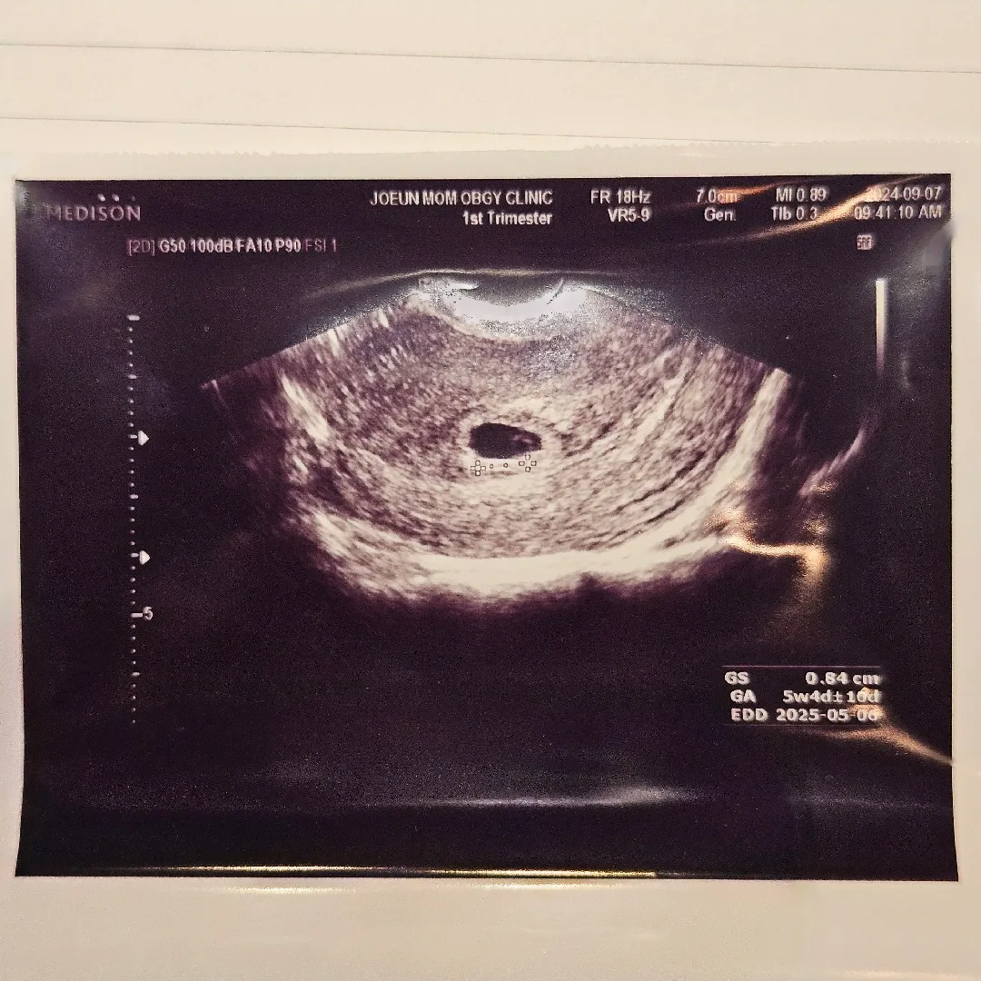 아가집 난황 드디어 보고왔네요!