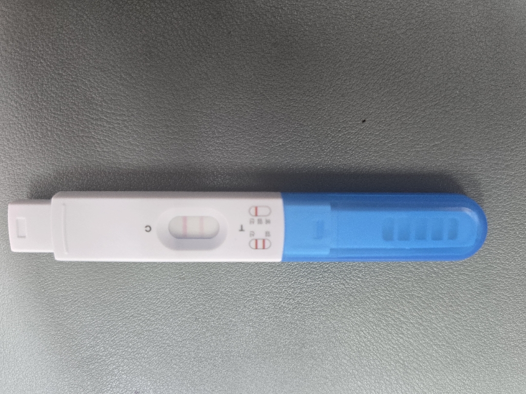 산부인과진료 내일 가면 아기집 볼수 있나요?