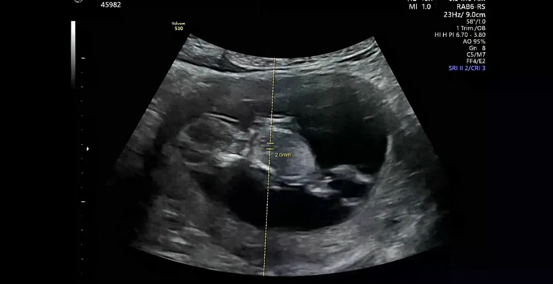 11주3일차 성별 뭘까용 ?