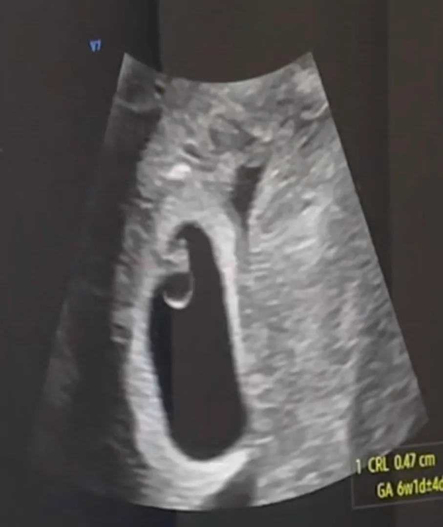 첫 심소 듣고 왔어요.!