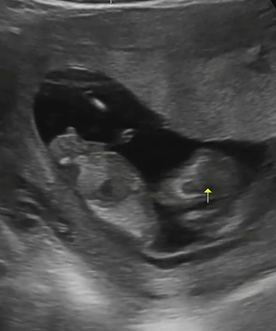 각도법 봐주세용!!👶🏻😊