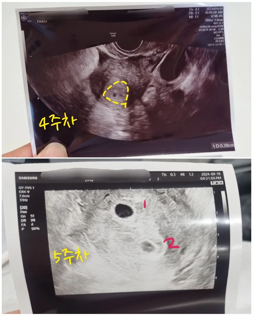 쌍둥이래요!